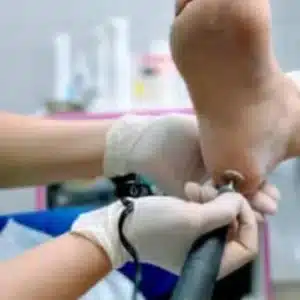 photo_full Апаратний педикюр у Харкові кабінет PodoExpert